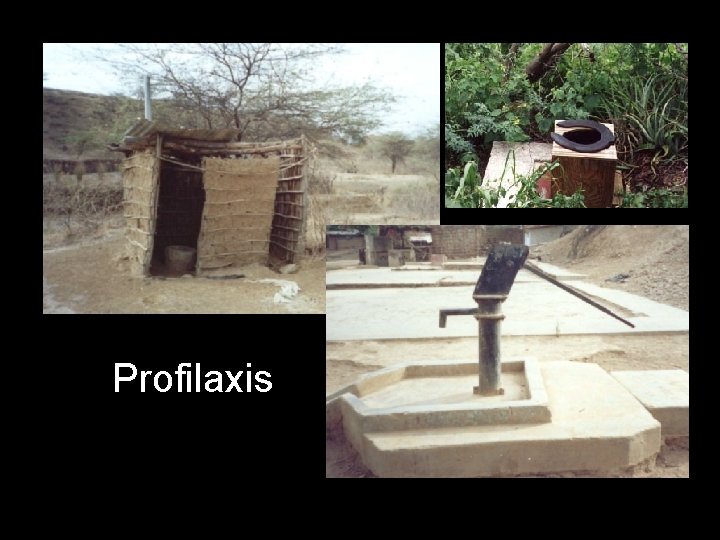 Profilaxis 