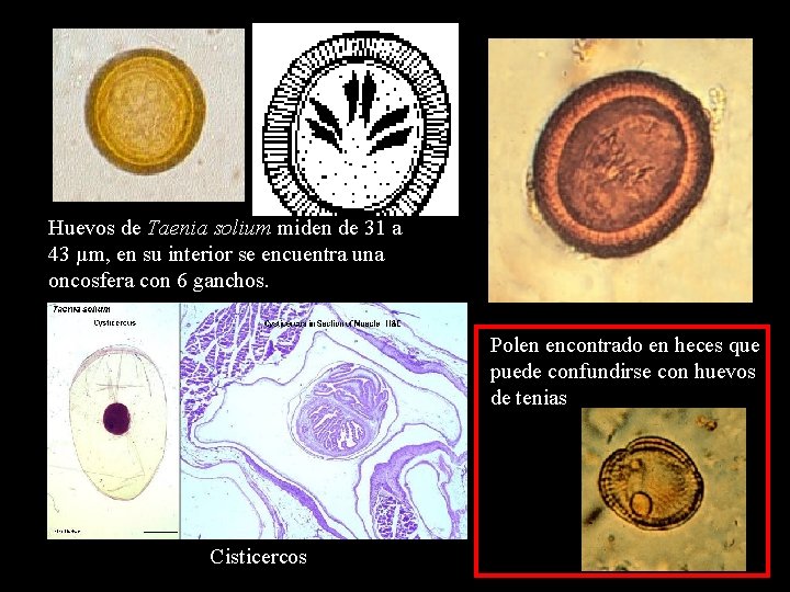 Huevos de Taenia solium miden de 31 a 43 µm, en su interior se