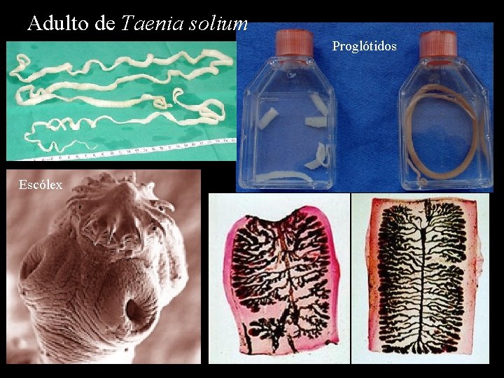 Adulto de Taenia solium Proglótidos Escólex 