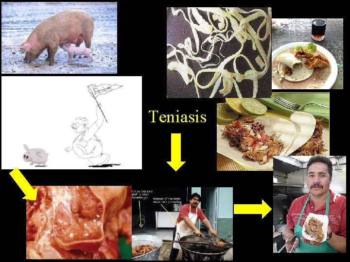 Teniasis 