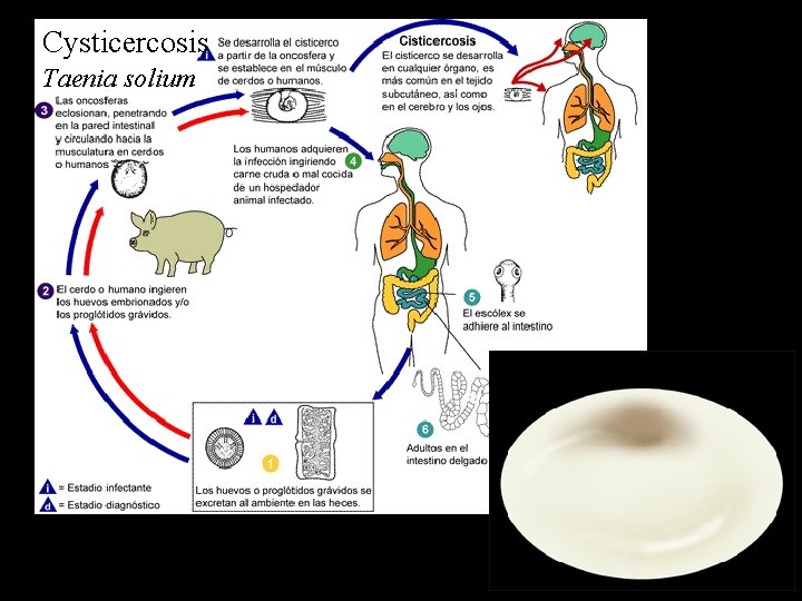 Cysticercosis Taenia solium 