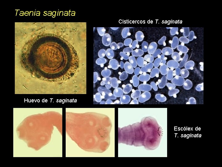 Taenia saginata Cisticercos de T. saginata Huevo de T. saginata Escólex de T. saginata