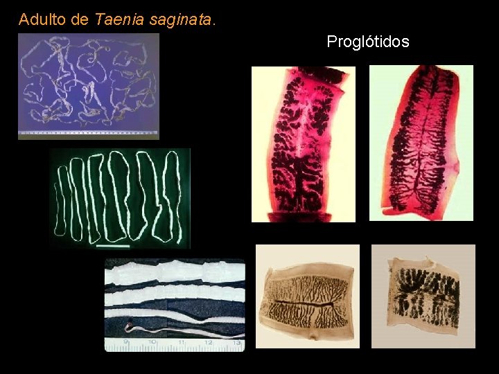 Adulto de Taenia saginata. Proglótidos 
