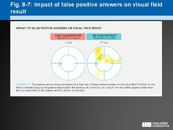 Fig. 8 -7: Impact of false positive answers on visual field result 