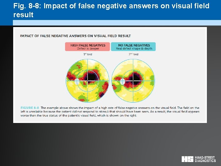 Fig. 8 -8: Impact of false negative answers on visual field result 