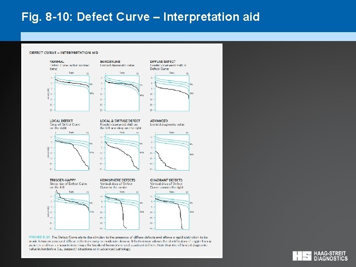 Fig. 8 -10: Defect Curve – Interpretation aid 