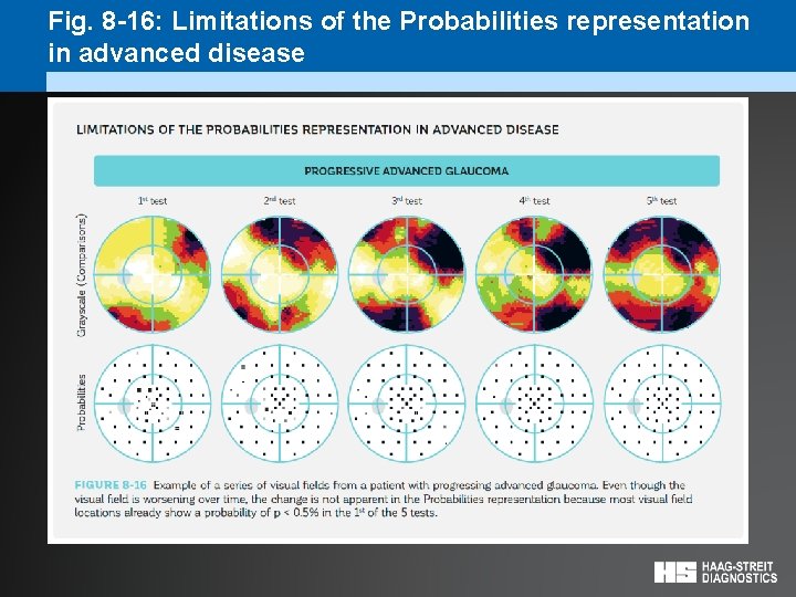 Fig. 8 -16: Limitations of the Probabilities representation in advanced disease 