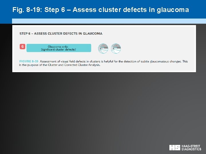 Fig. 8 -19: Step 6 – Assess cluster defects in glaucoma 