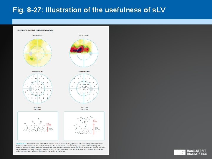 Fig. 8 -27: Illustration of the usefulness of s. LV 