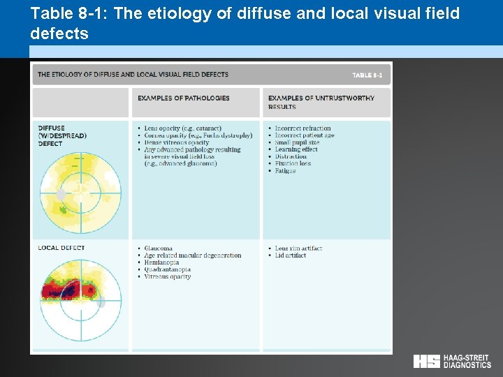 Table 8 -1: The etiology of diffuse and local visual field defects 