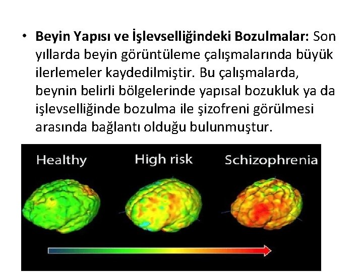  • Beyin Yapısı ve İşlevselliğindeki Bozulmalar: Son yıllarda beyin görüntüleme çalışmalarında büyük ilerlemeler