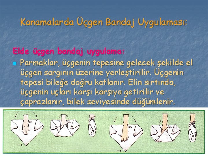 Kanamalarda Üçgen Bandaj Uygulaması: Elde üçgen bandaj uygulama: n Parmaklar, üçgenin tepesine gelecek şekilde Kanamalarda Üçgen Bandaj Uygulaması: Elde üçgen bandaj uygulama: n Parmaklar, üçgenin tepesine gelecek şekilde