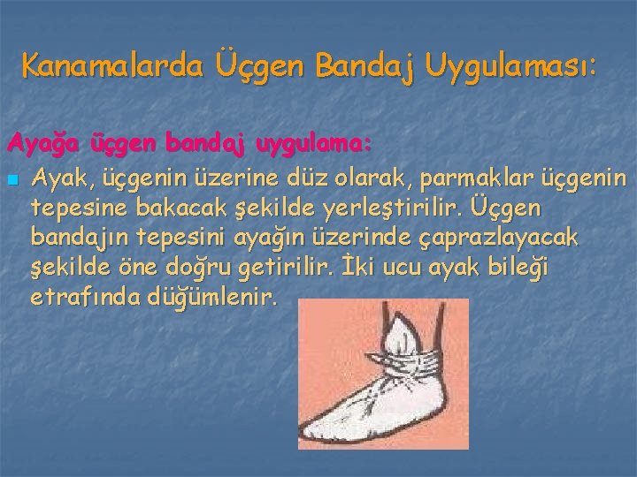 Kanamalarda Üçgen Bandaj Uygulaması: Ayağa üçgen bandaj uygulama: n Ayak, üçgenin üzerine düz olarak,