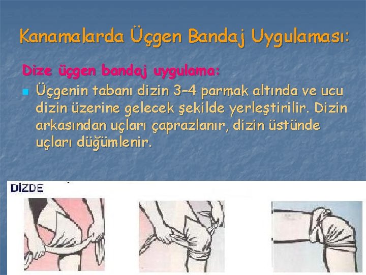 Kanamalarda Üçgen Bandaj Uygulaması: Dize üçgen bandaj uygulama: n Üçgenin tabanı dizin 3– 4 Kanamalarda Üçgen Bandaj Uygulaması: Dize üçgen bandaj uygulama: n Üçgenin tabanı dizin 3– 4