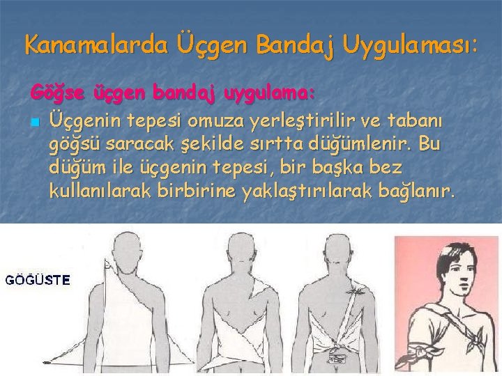 Kanamalarda Üçgen Bandaj Uygulaması: Göğse üçgen bandaj uygulama: n Üçgenin tepesi omuza yerleştirilir ve