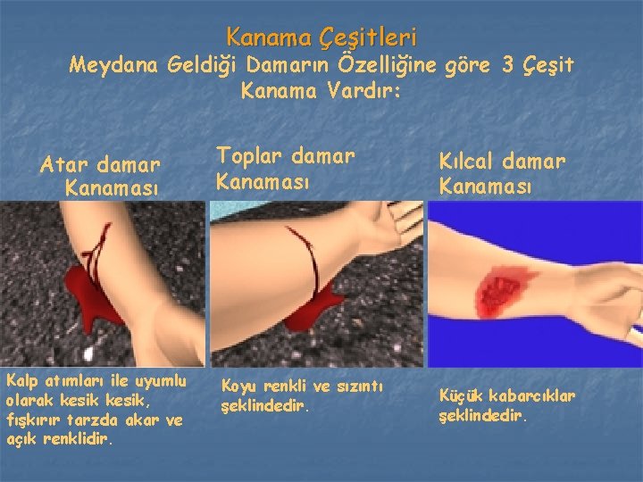 Kanama Çeşitleri Meydana Geldiği Damarın Özelliğine göre 3 Çeşit Kanama Vardır: Atar damar Kanaması