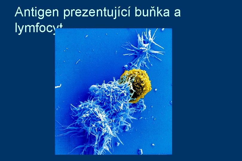 Antigen prezentující buňka a lymfocyt 