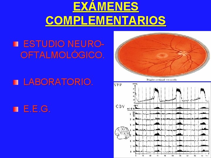 EXÁMENES COMPLEMENTARIOS ESTUDIO NEUROOFTALMOLÓGICO. LABORATORIO. E. E. G. 