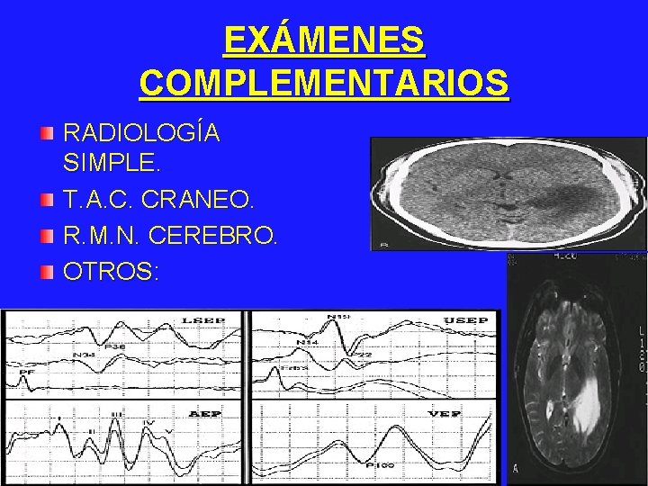 EXÁMENES COMPLEMENTARIOS RADIOLOGÍA SIMPLE. T. A. C. CRANEO. R. M. N. CEREBRO. OTROS: 