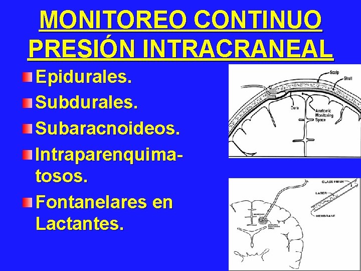 MONITOREO CONTINUO PRESIÓN INTRACRANEAL Epidurales. Subaracnoideos. Intraparenquimatosos. Fontanelares en Lactantes. 