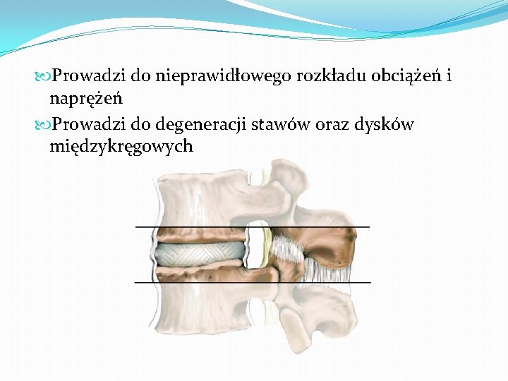  Prowadzi do nieprawidłowego rozkładu obciążeń i naprężeń Prowadzi do degeneracji stawów oraz dysków