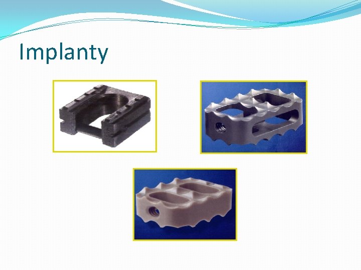 Implanty 