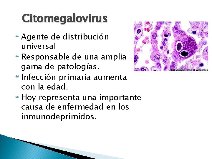 Citomegalovirus Agente de distribución universal Responsable de una amplia gama de patologías. Infección primaria