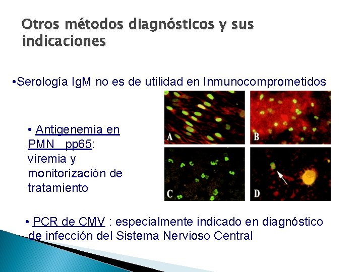 Otros métodos diagnósticos y sus indicaciones • Serología Ig. M no es de utilidad