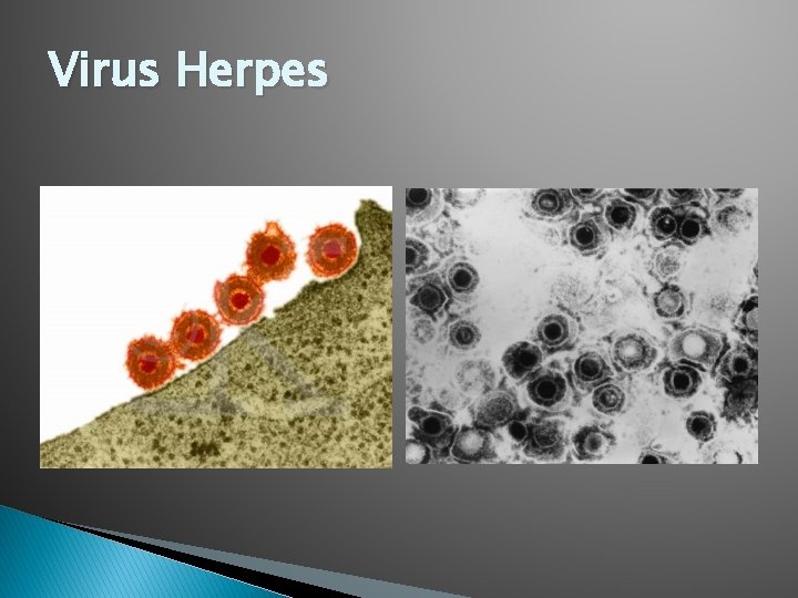 Virus Herpes 