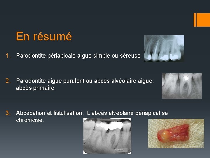 En résumé 1. Parodontite périapicale aigue simple ou séreuse 2. Parodontite aigue purulent ou