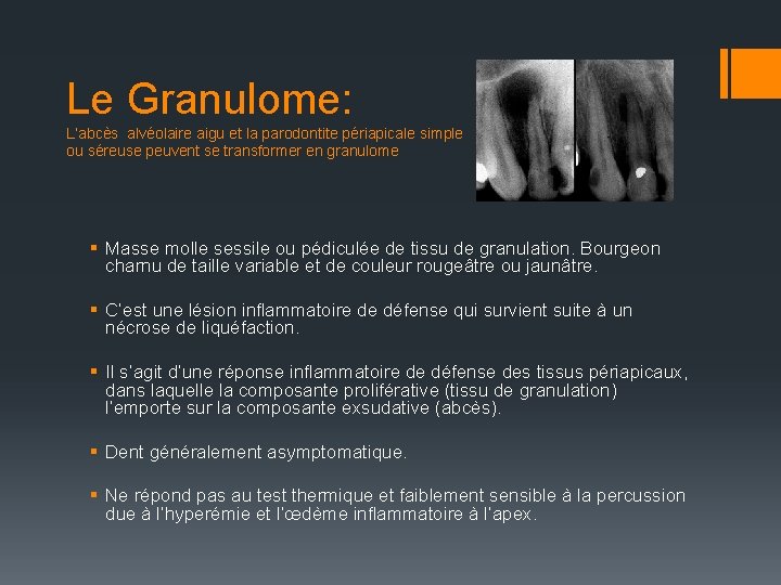 Le Granulome: L’abcès alvéolaire aigu et la parodontite périapicale simple ou séreuse peuvent se