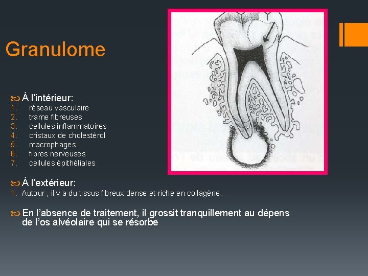 Granulome À l’intérieur: 1. 2. 3. 4. 5. 6. 7. réseau vasculaire trame fibreuses