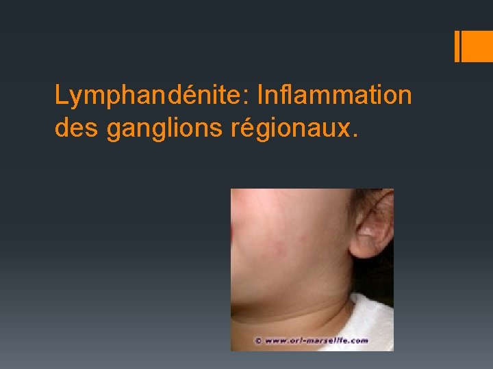 Lymphandénite: Inflammation des ganglions régionaux. 