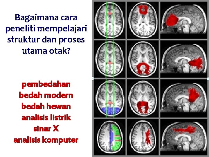 Bagaimana cara peneliti mempelajari struktur dan proses utama otak? pembedahan bedah modern bedah hewan