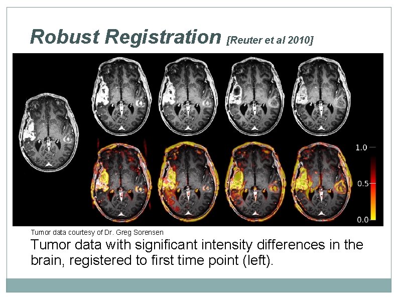 Robust Registration [Reuter et al 2010] Tumor data courtesy of Dr. Greg Sorensen Tumor