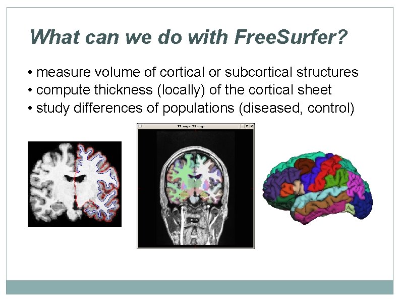 What can we do with Free. Surfer? • measure volume of cortical or subcortical