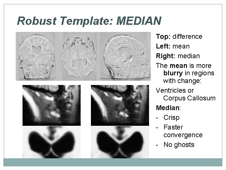 Robust Template: MEDIAN Top: difference Left: mean Right: median The mean is more blurry