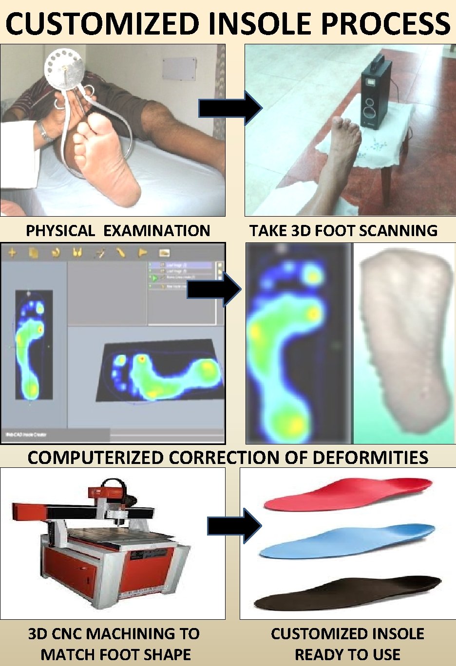 CUSTOMIZED INSOLE PROCESS PHYSICAL EXAMINATION TAKE 3 D FOOT SCANNING COMPUTERIZED CORRECTION OF DEFORMITIES