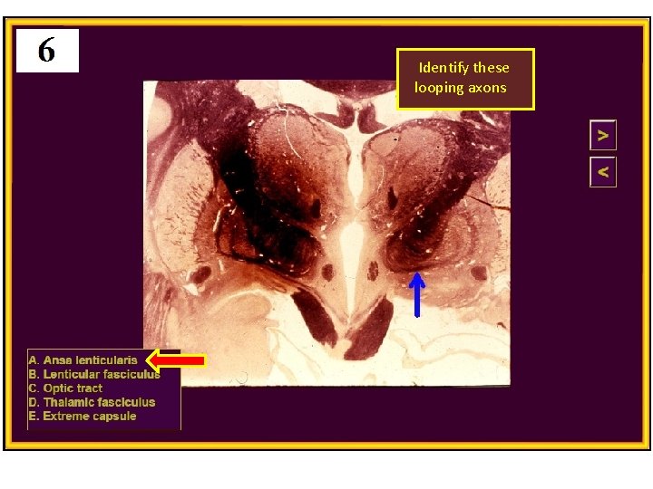 Identify these looping axons 