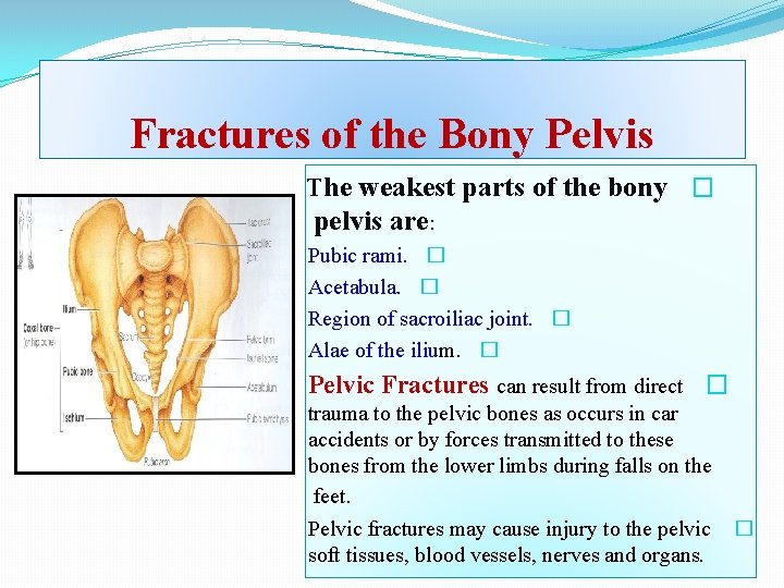 Fractures of the Bony Pelvis The weakest parts of the bony � pelvis are:
