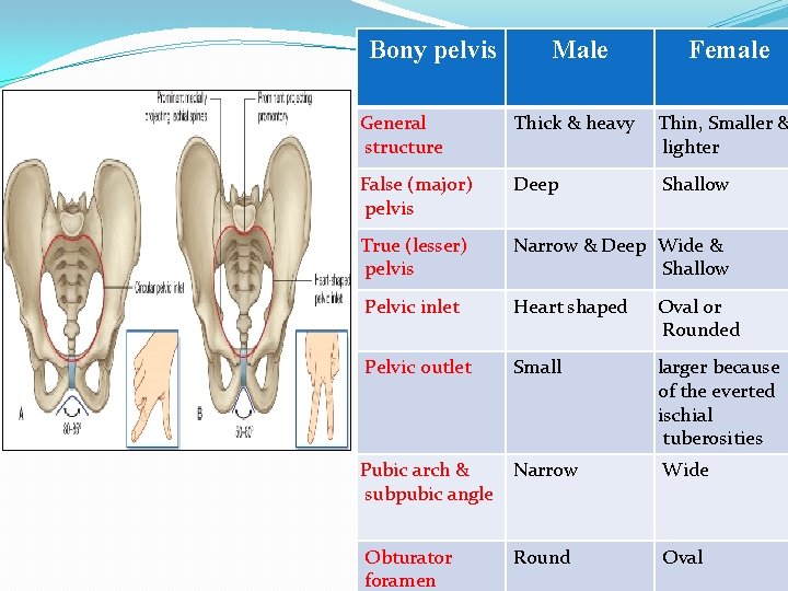 Bony pelvis Male Female General structure Thick & heavy Thin, Smaller & lighter False