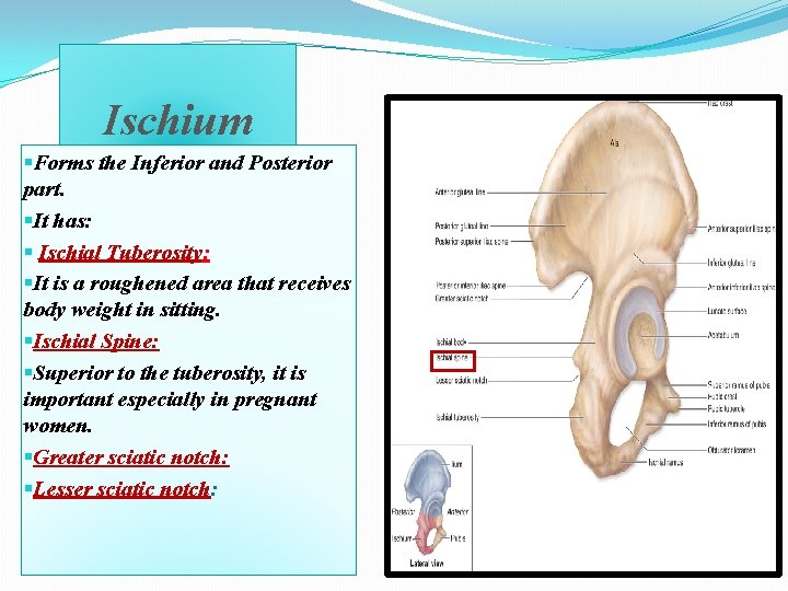 Ischium §Forms the Inferior and Posterior part. §It has: § Ischial Tuberosity: §It is