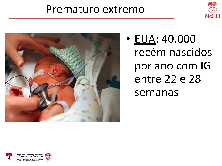 Prematuro extremo • EUA: 40. 000 recém nascidos por ano com IG entre 22