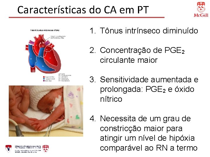 Características do CA em PT 1. Tônus intrínseco diminuído 2. Concentração de PGE 2