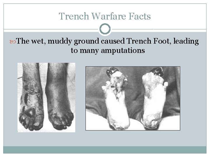 Trench Warfare Facts The wet, muddy ground caused Trench Foot, leading to many amputations