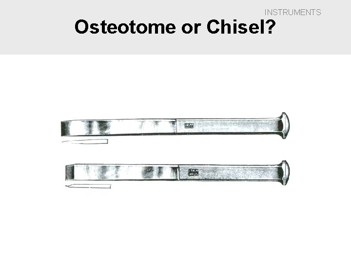 INSTRUMENTS Osteotome or Chisel? 