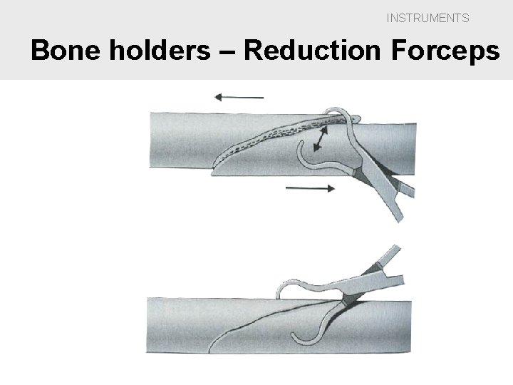 INSTRUMENTS Bone holders – Reduction Forceps 
