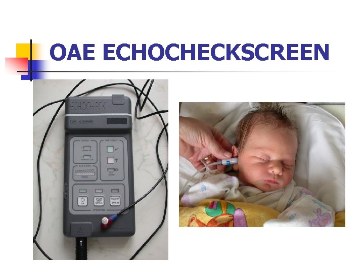 OAE ECHOCHECKSCREEN 