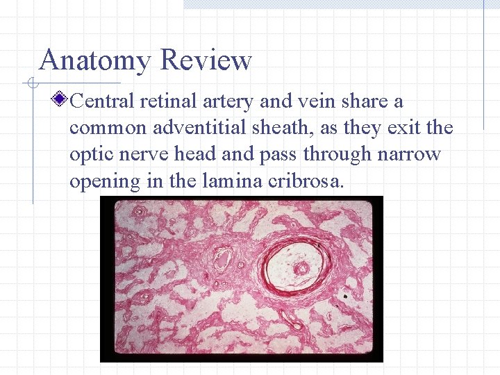 Anatomy Review Central retinal artery and vein share a common adventitial sheath, as they