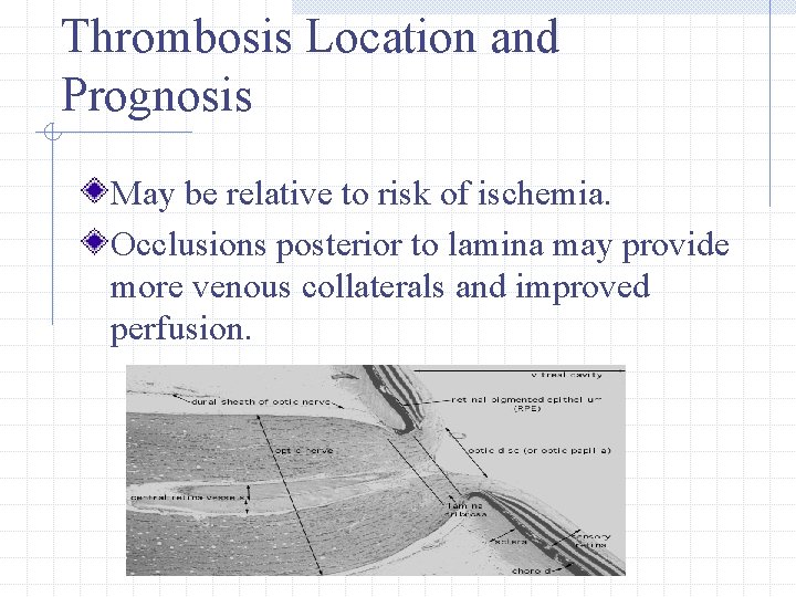 Thrombosis Location and Prognosis May be relative to risk of ischemia. Occlusions posterior to